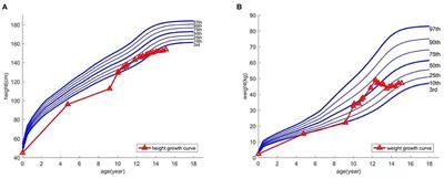 Case Report: Improved Height in a Patient With Myhre Syndrome Using a Combination of Growth Hormone and Letrozole